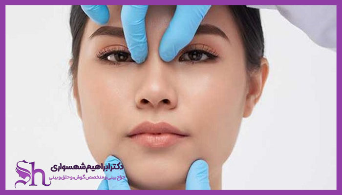 انواع روتوش بینی