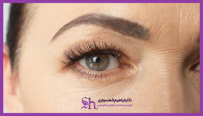 اهمیت زیبایی ناحیه پیشانی و ابرو