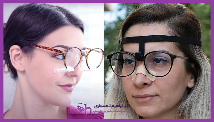 جایگزینهای موقت عینک بعد از عمل بینی