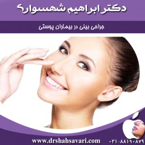 جراحی بینی در بیماران پوستی