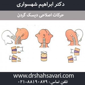 حرکات اصلاحی دیسک گردن