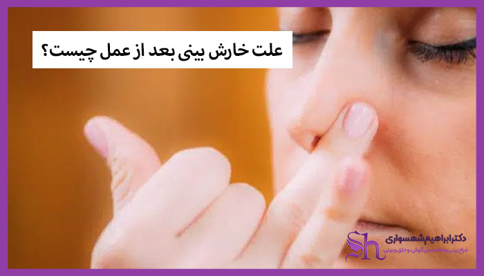 علت خارش بینی بعد از عمل چیست؟