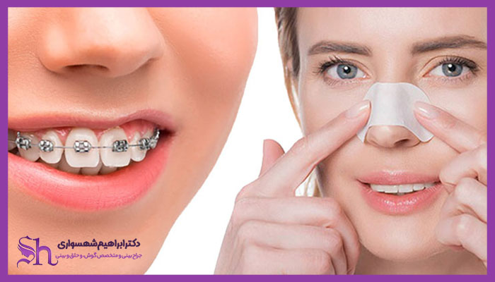 جراحی بینی همزمان با ارتودنسی ممکن است؟