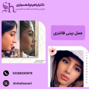 نمونه جراحی بینی فانتزی