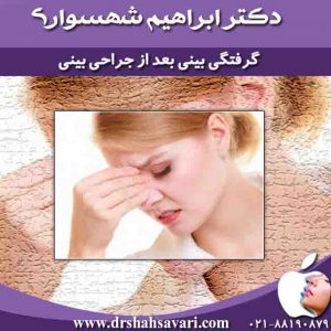 گرفتگی بینی بعد از جراحی بینی