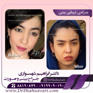 عمل بینی