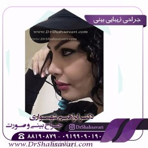 عمل بینی