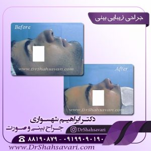 عمل بینی