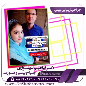 عمل بینی