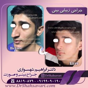 عمل بینی