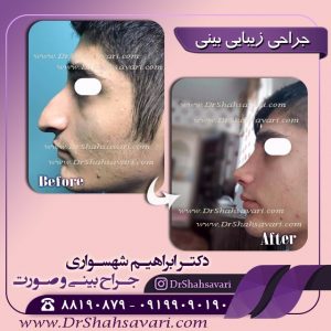 عمل بینی