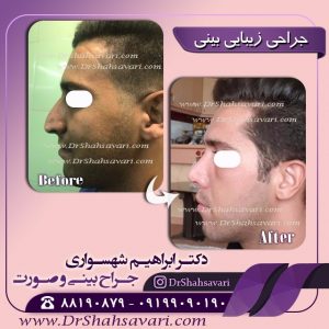 عمل بینی