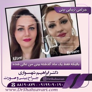 عمل بینی