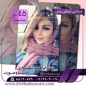 عمل بینی