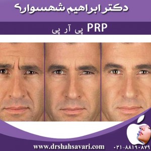 prp