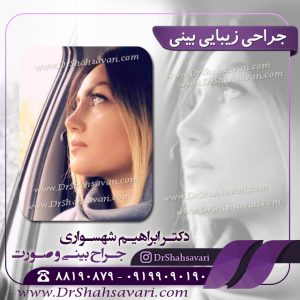 عمل بینی
